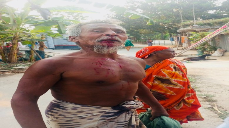 ভেড়ামারায় জমিজমা সংক্রান্ত বিরোধের জেরে হামলায় আহত ৩ :: থানা