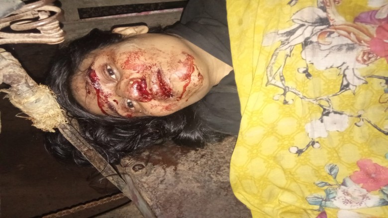 সান্তাহারে স্বামীর সঙ্গে বিরোধের জেরে চলন্ত ট্রেন থেকে লাফ, 