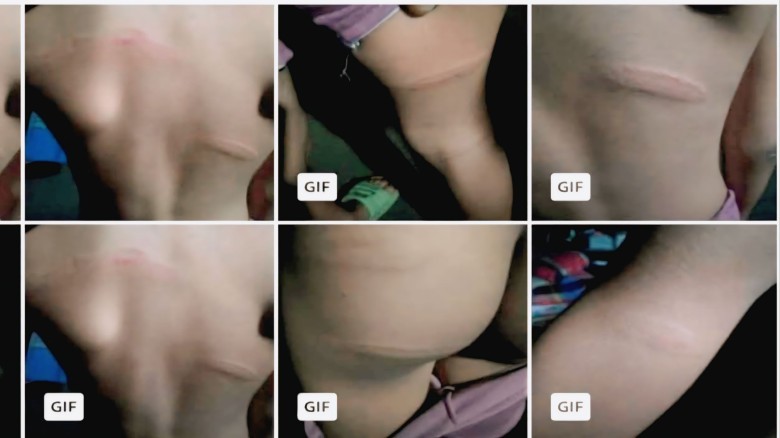 এতিম শিশুর ওপর নির্মমতা  ফুলপুর মাদ্রাসায় শিক্ষকের বর্বর মার