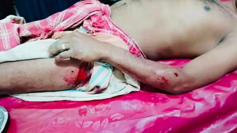 কুষ্টিয়ার দৌলতপুরে মধ্যযুগীয় কায়দায় পেরেক ঢুকিয়ে নির্মম নির্