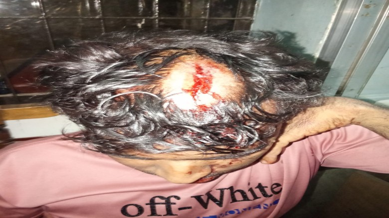 বিজয়নগরে জুলাই যোদ্ধার ওপর হত্যাচেষ্টা ও হামলা